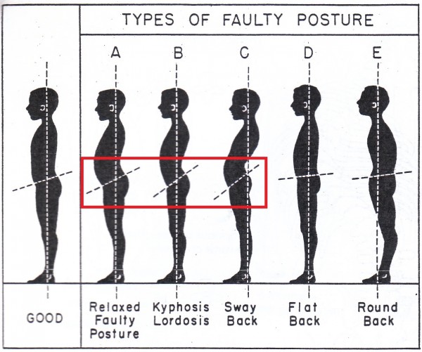 faulty-postures
