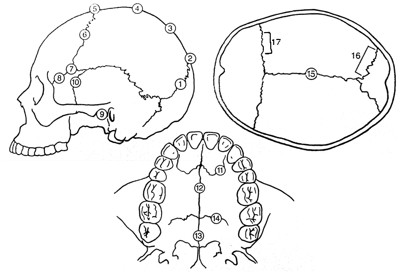 cranial-suture-locations