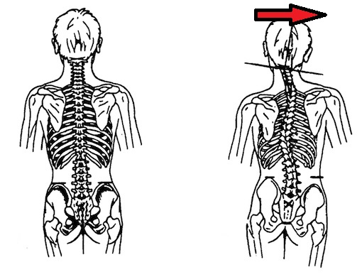 Atlas-and-spinal-alignement